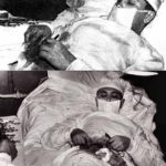 rogozov self surgery