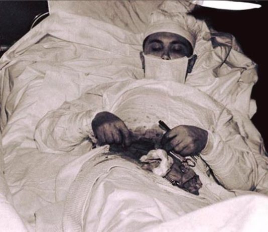 Ρογκοζώφ – Η ιστορία του νεαρού γιατρού που έκανε εγχείρηση στον εαυτό του